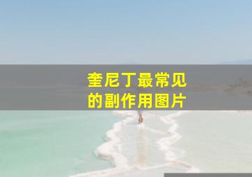 奎尼丁最常见的副作用图片